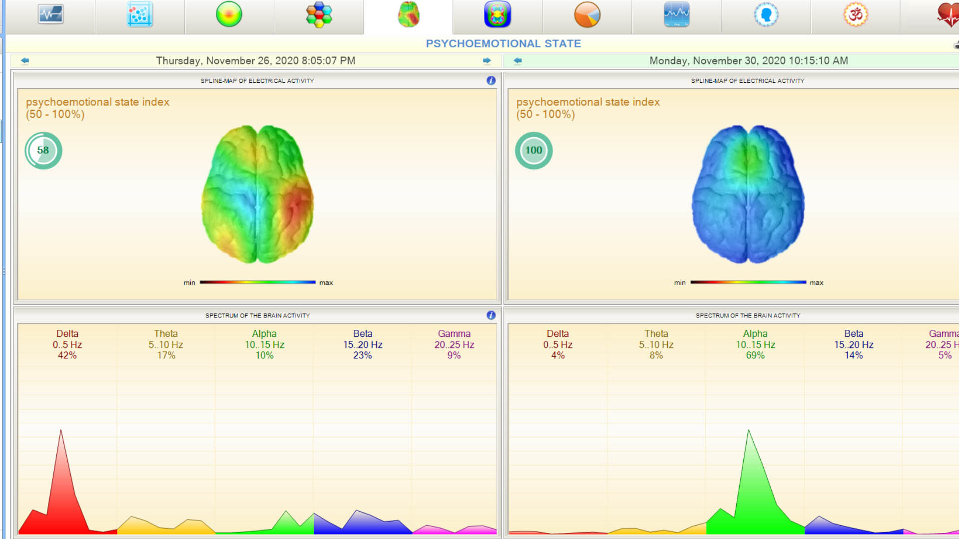 AmpCoil & VScan HRV Bundle AmpCoil & VScan HRV Bundle